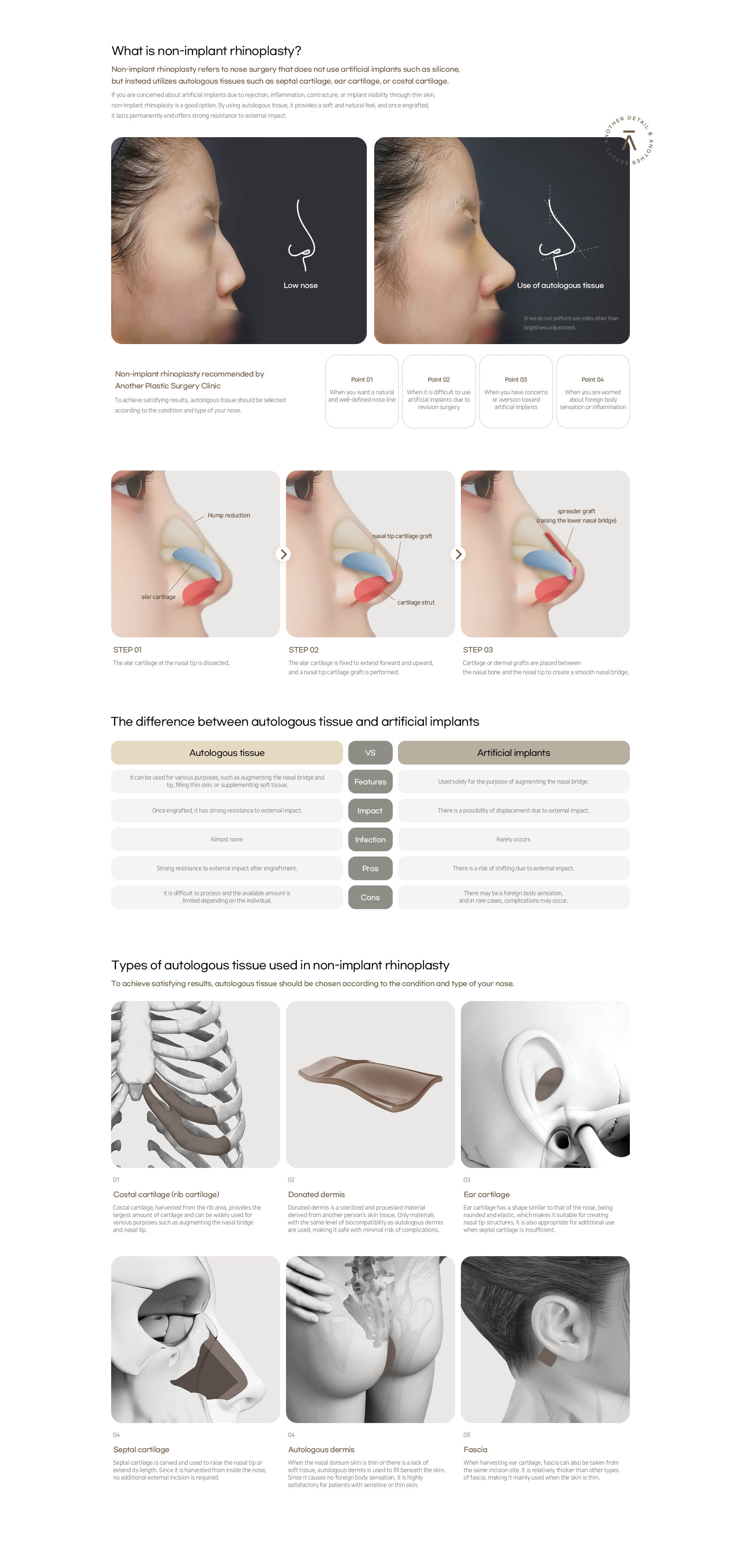 Implant-Free Rhinoplasty