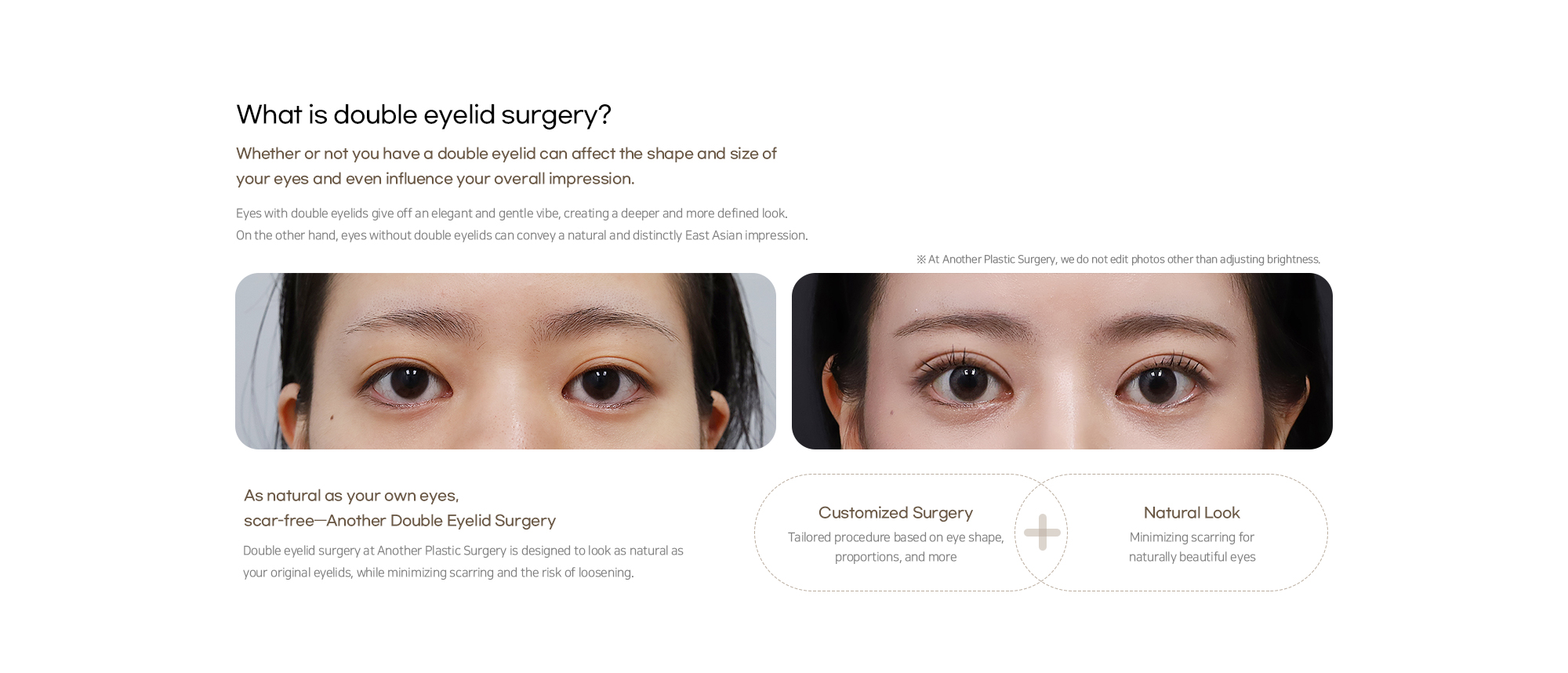 Double Eyelid Surgery