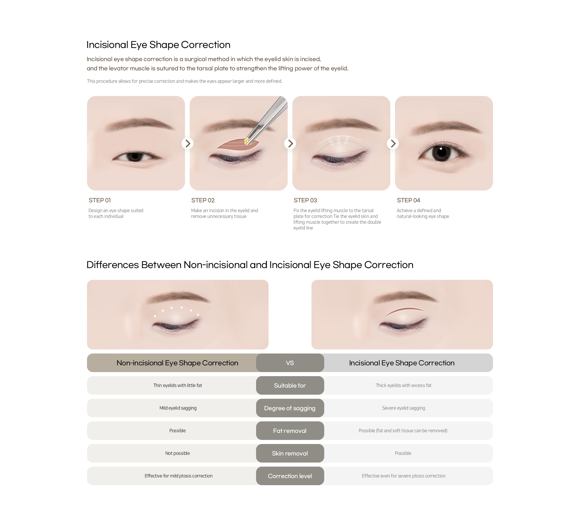 Another Plastic Surgery Incisional Eye Shape Correction