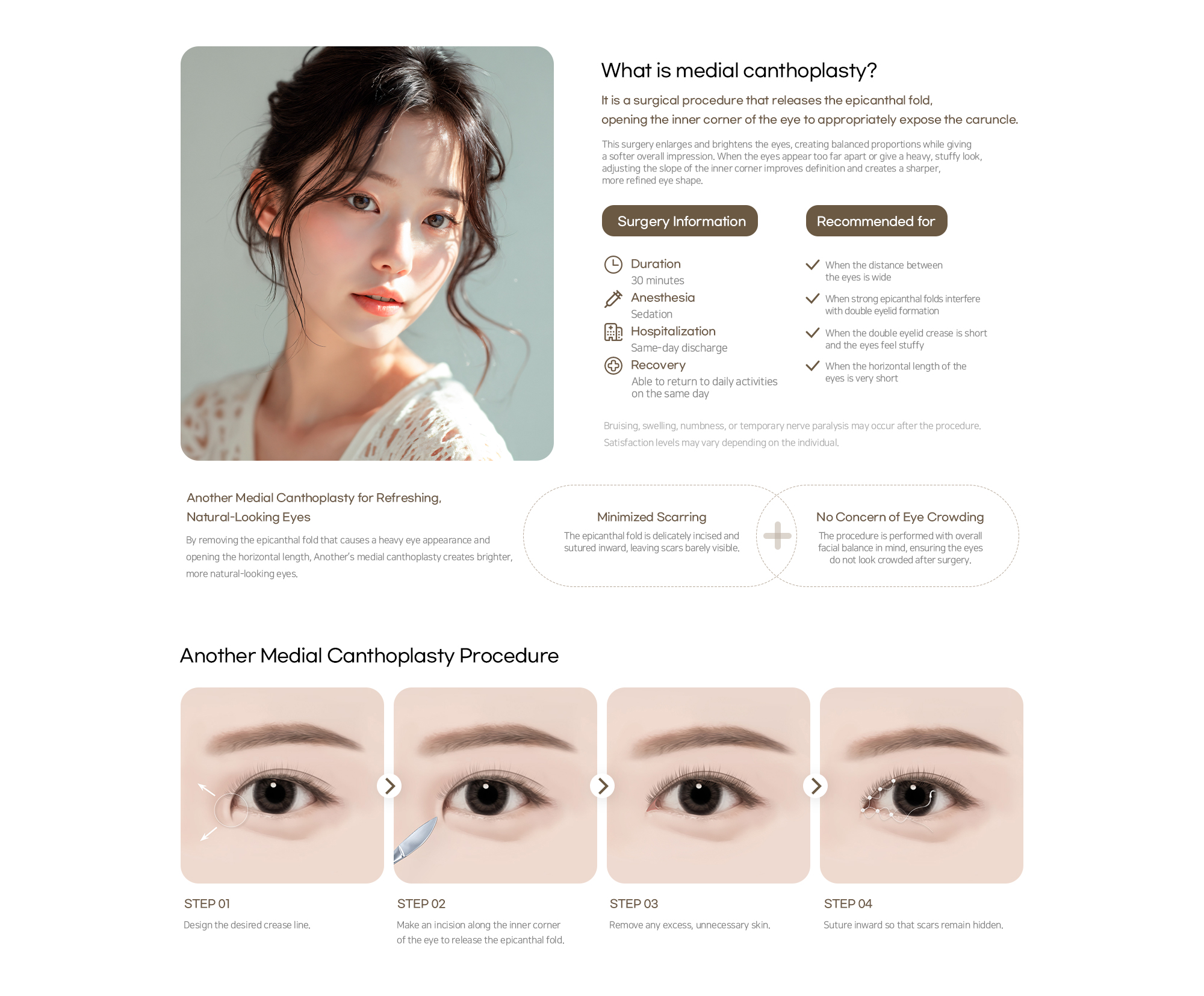 Another Plastic Surgery Medial canthoplasty