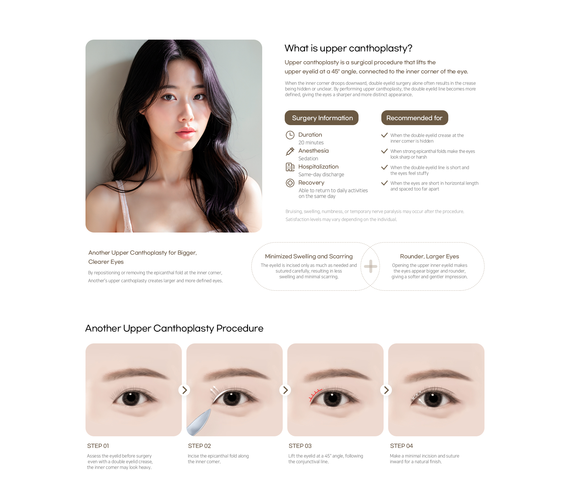 Another Plastic Surgery Upper canthoplasty