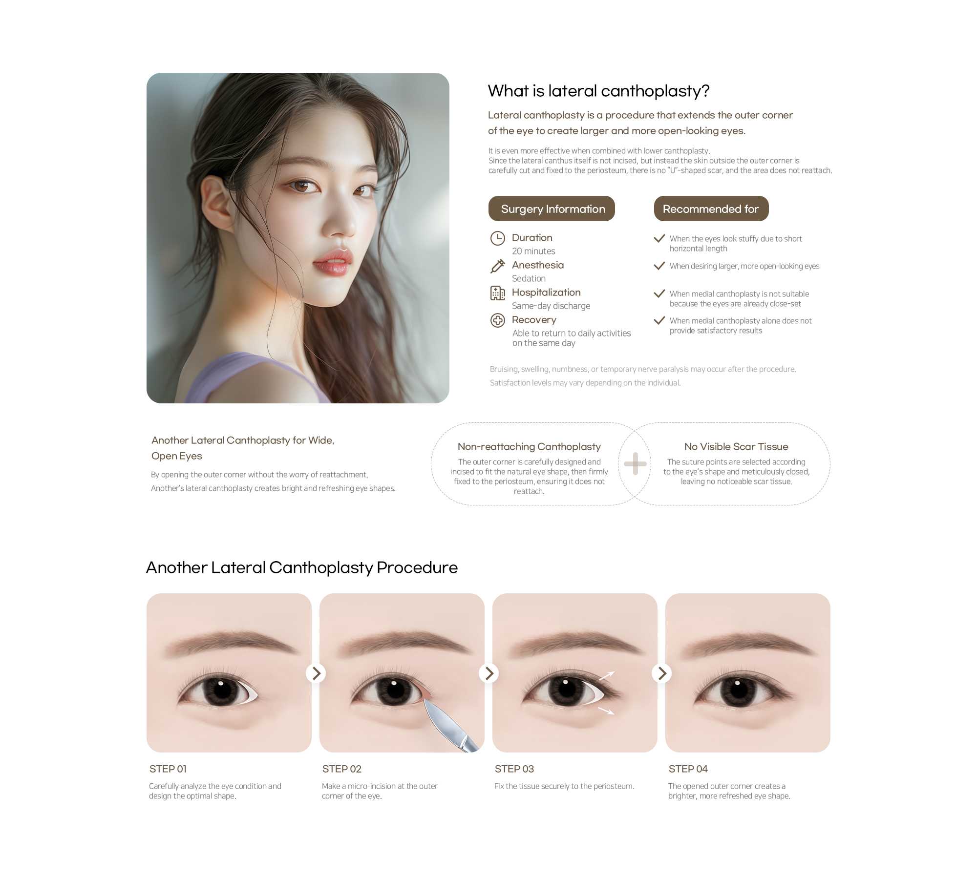Another Plastic Surgery Lateral canthoplasty