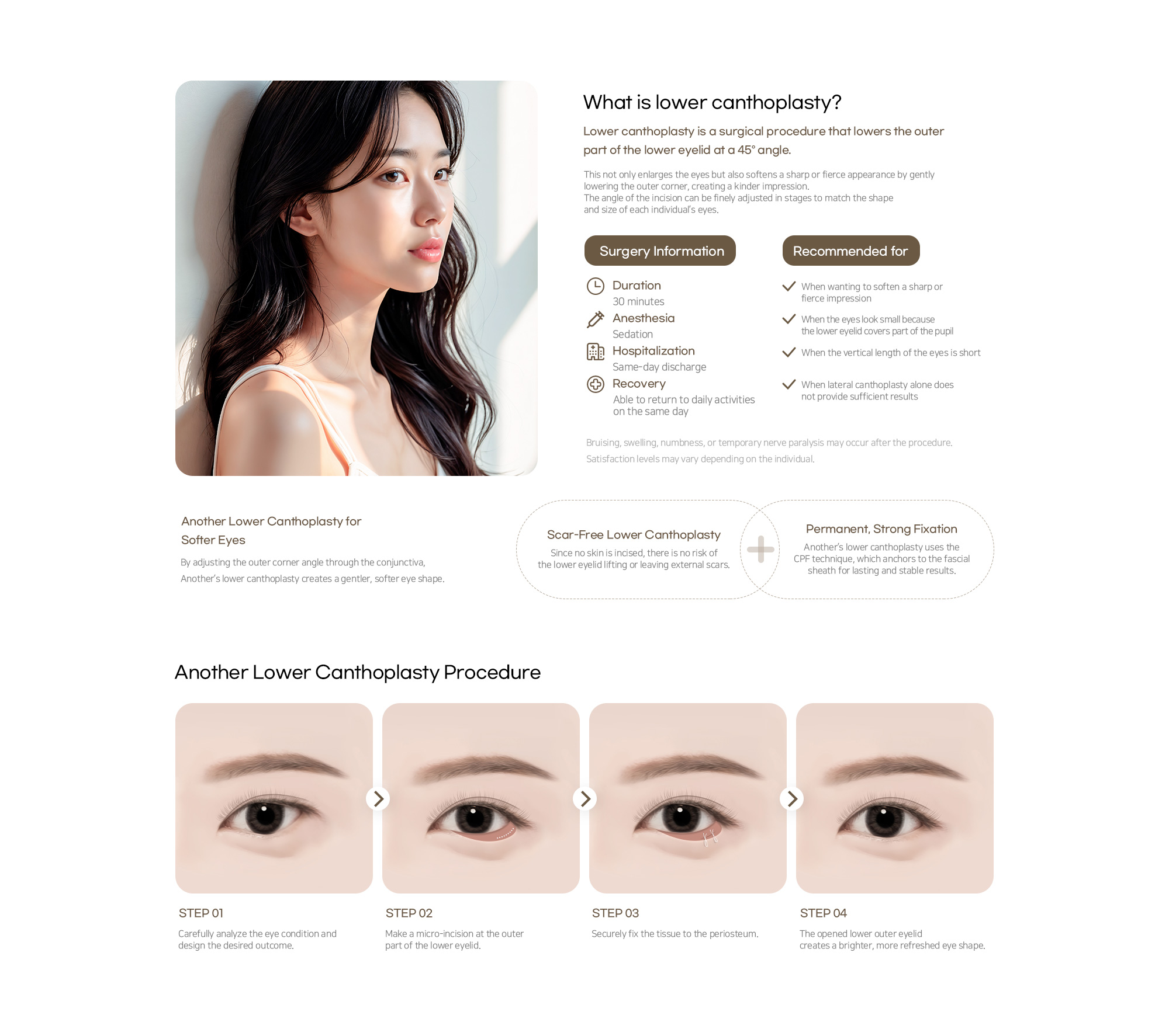 Another Plastic Surgery Lower canthoplasty