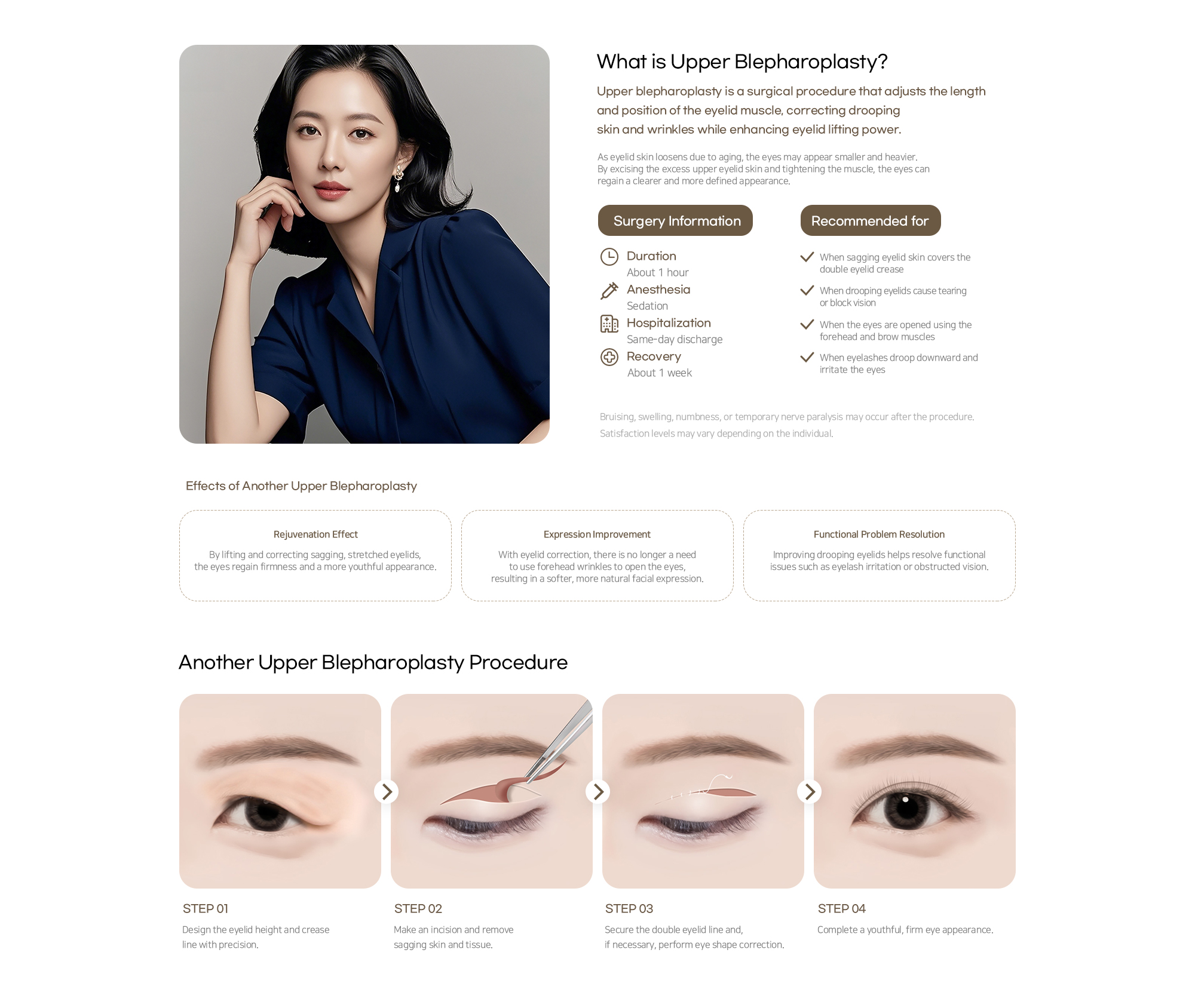 Another Plastic Surgery Upper blepharoplasty