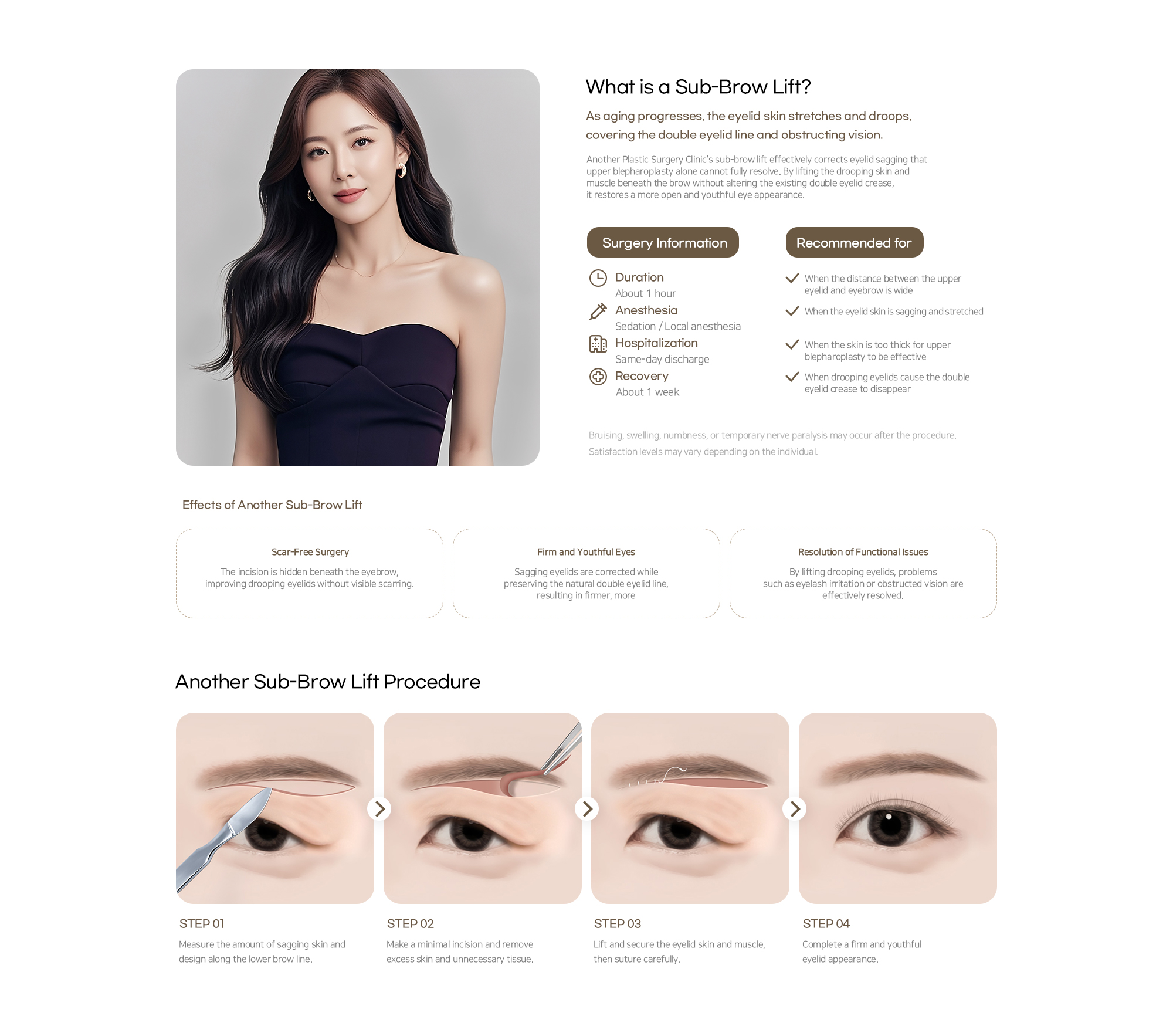 Another Plastic Surgery Sub-brow lift