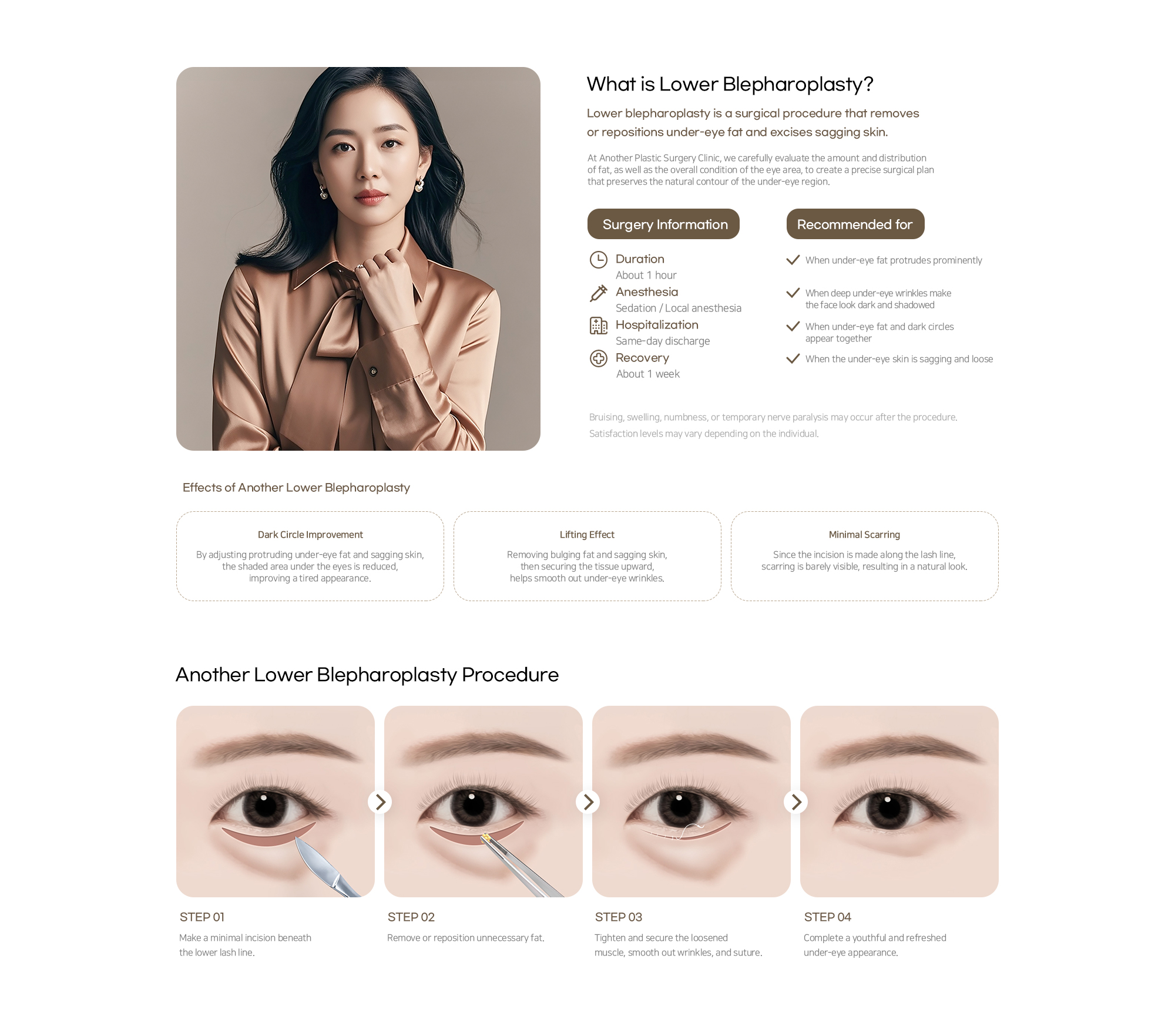 Another Plastic Surgery Lower blepharoplasty